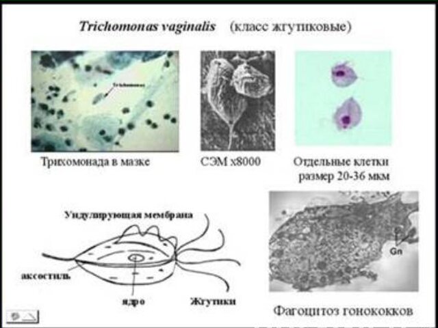 Возбудитель трихомоноза