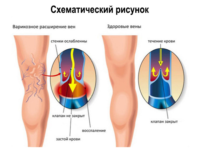 Схематический рисунок 