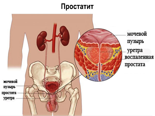 Схематический рисунок