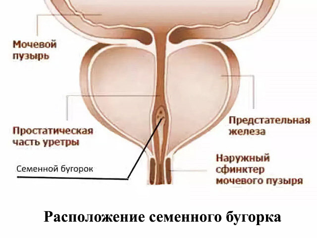 Что такое колликулит у мужчин это фото