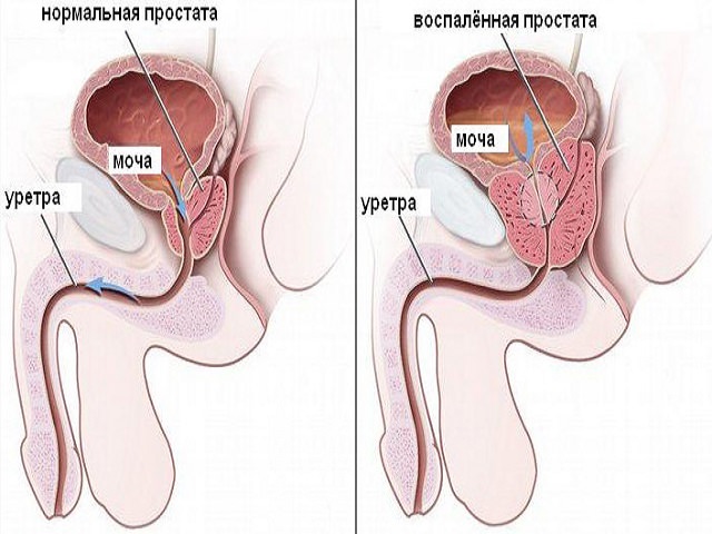 Схематический рисунок 