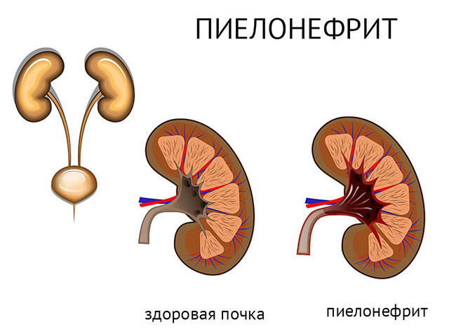 Схематический рисунок 