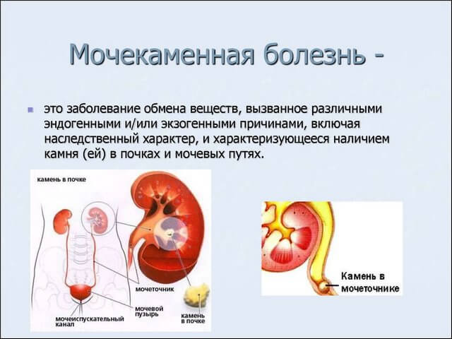 Схематический рисунок 