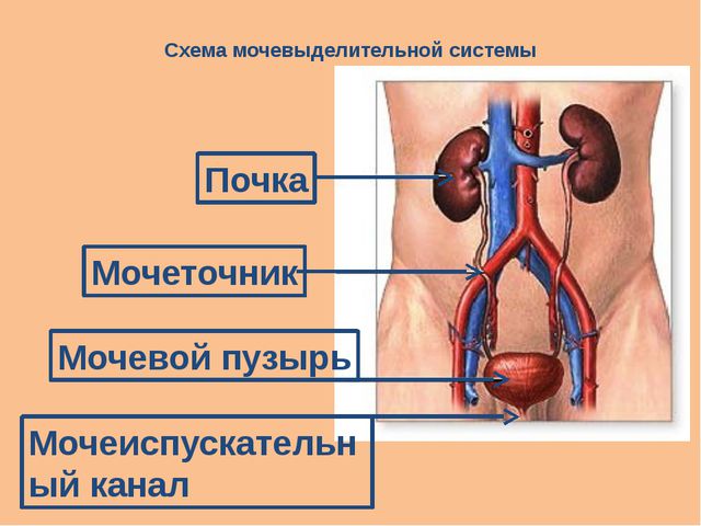 Схематический рисунок 