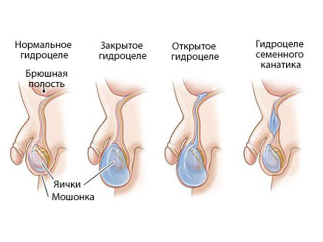 Схематический рисунок 