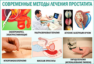 Схема лечения простатита у мужчин, схема лечения хронического простатита